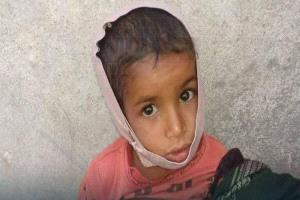 بدم بارد.. جماعة الحوثي تغتال طفولة وجدي في تعز بقصف مدفعي عشوائي