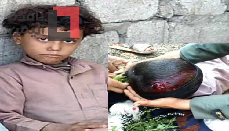 مسلح يفجر رأس طفل برصاصة بشكل مفاجئ ودون سبب جنوب صنعاء