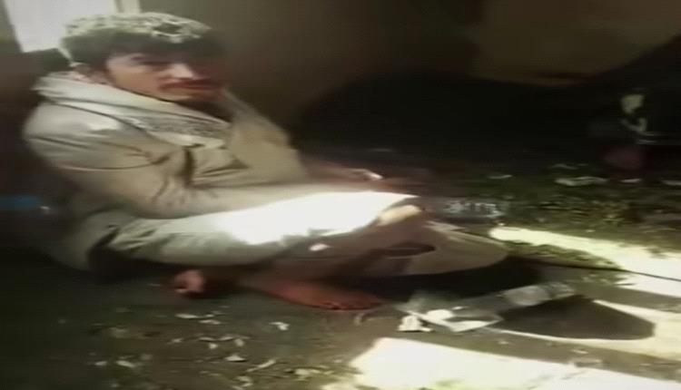 مقتل طفل بوحشية على يد مشعوذ بعد ضرب مروّع وتحطيم الرأس شمال صنعاء