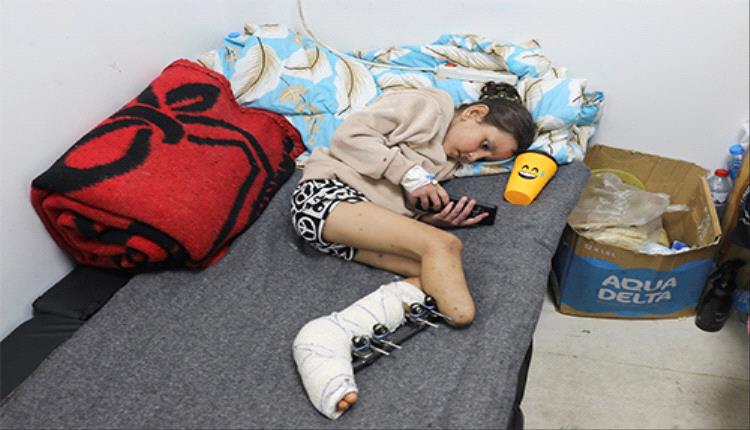 5 آلاف تم بتر أطرافهم.. 24 الف شخص في غزة يعانون من اصابات غيرت مجرى حياتهم