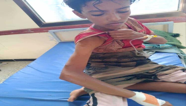 نجا من الموت بأعجوبة.. قناص حوثي يصيب طفلًا أثناء رعيه الأغنام شمال لحج