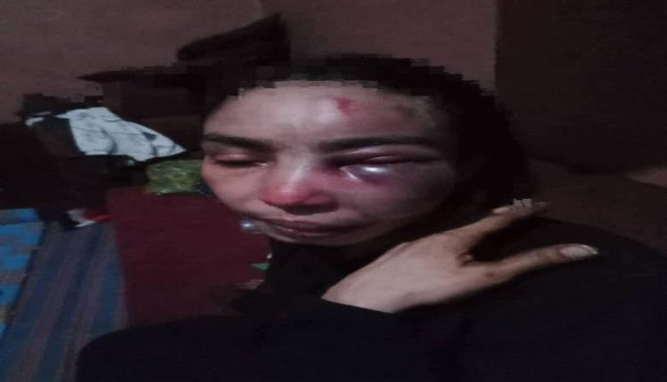 امرأة تُعذب بوحشية على يد طليقها العسكري أمام الناس في تعز