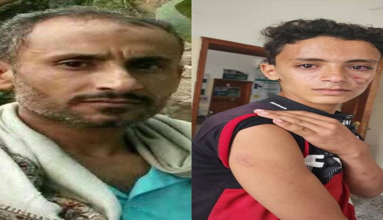 مشرف حوثي يُسقط طفل مغشيا عليه ويعتدي بوحشية على والدته بعد محاولتها الدفاع عنه