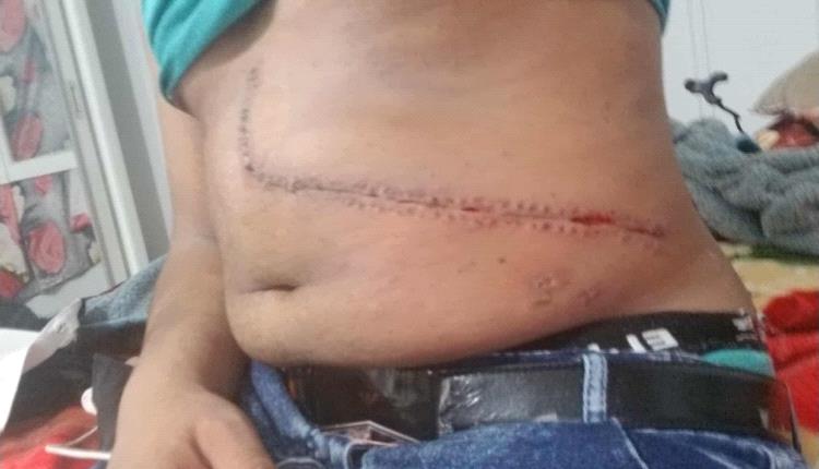 عائلة ثرية تخدع شاب فقير وتسرق كبده ثم تتخلى عنه بعد إنقاذهم أحد أبنائها في إب