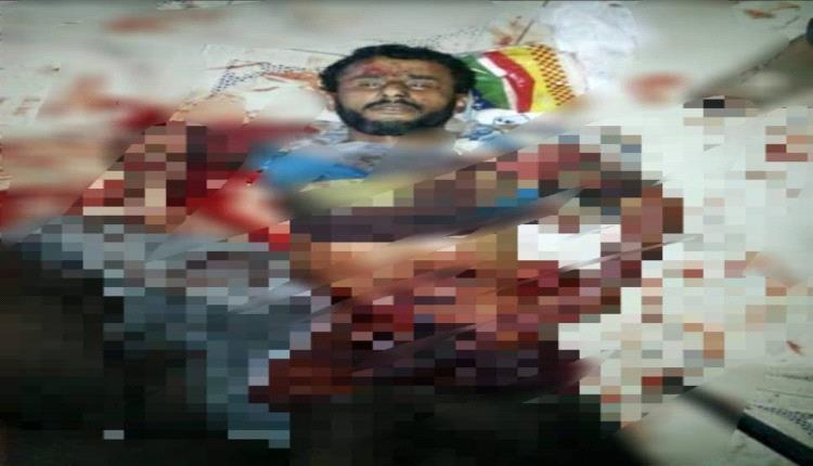 تعذيب وحشي لمواطن على يد عناصر حزب الإصلاح بمعسكر الصدرين