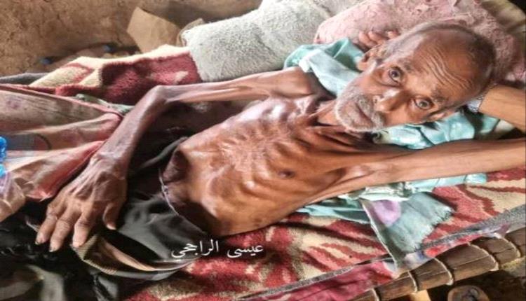 الجوع وسوء التغذية يودي بحياة مسن بحجة