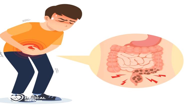 عادات صحية تقلل من خطر الإصابة بالإمساك.. تعرف عليها 