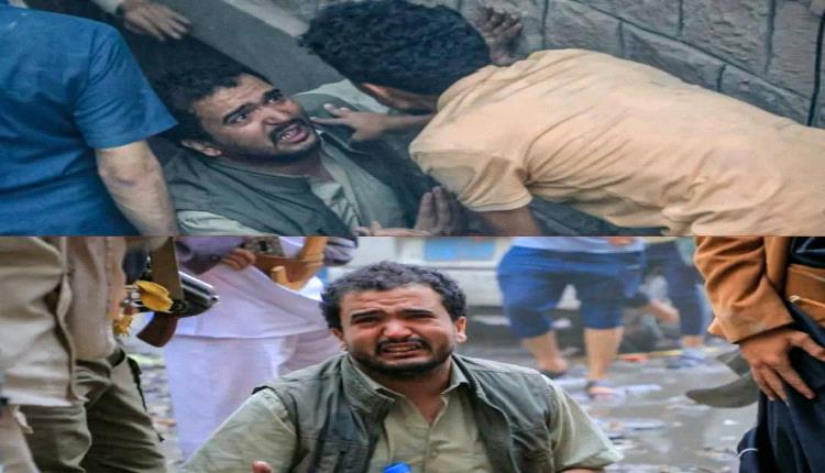 جرحى قصف صنعاء يواجهون الموت مرتين.. الحوثي يترك المصابين بلا إسعاف في الجمهوري