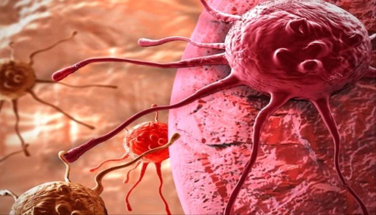 علماء روس ينجحون فى تخليق مركب عضوي يمنع خلايا السرطان من النمو والتكاثر