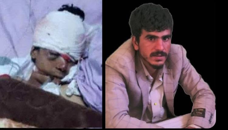مشرف حوثي يكسر جمجمة طفل ويقتلع عينيه وآخر يضرب طفل يوحشية ويهدد بذبحه في صنعاء