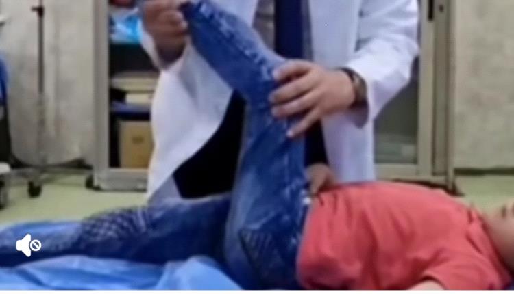 قصة موجعة من صنعاء.. طبيب يروي كيف تحوّل تردد أب إلى مأساة أفقدت طفله السمع