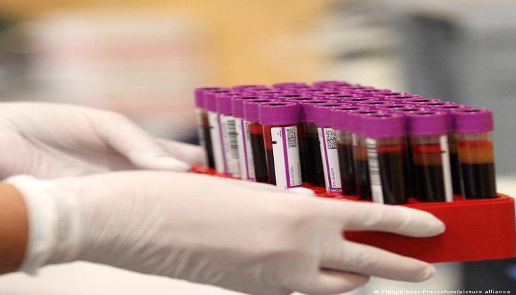 اكتشاف علامة مبكرة خفية للإصابة بالسرطان