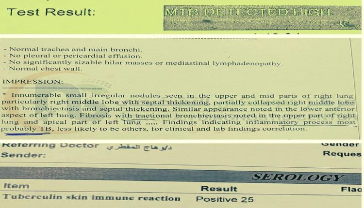 طبيب في صنعاء يكشف وهم التيفود ويُعري خللاً خطيراً بالفحوصات الطبية 