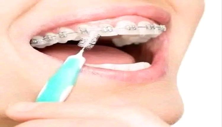 تنظيف الأسنان 4 دقائق يومياً يجنبك خطر التسوس وأمراض اللثة 
