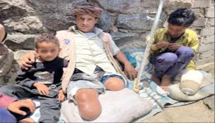 أكثر من 11 ألف مدني بين قتيل ومصاب بالغام الحوثيين