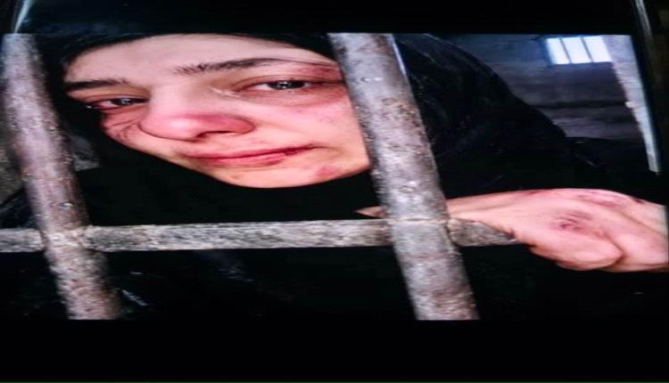 الجحفلي يكشف عن تعرض الإعلامية سحر الخولاني للاعتداء الجسدي بموافقة قيادات عليا