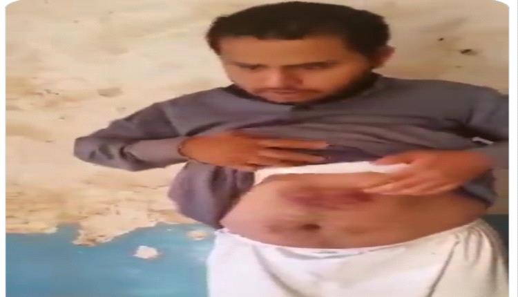 تعذيب ونهب داخل صعدة.. قيادات حوثية تزج بمواطن في السجن وتفبرك له تهم المخدرات
