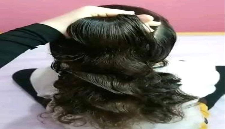 طبيبة تكشف أسبابًا خطيرة لتساقط الشعر