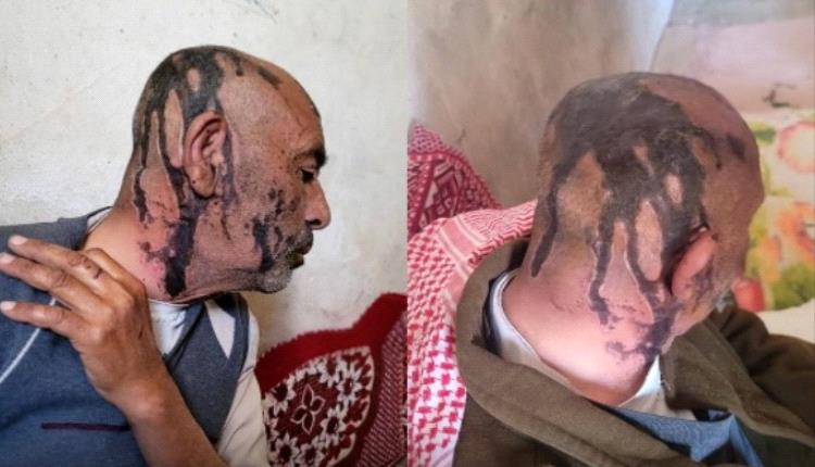 بالصورة.. أب يمني يتعرض للضرب المبرح من قبل أبنائه المنخرطين مع الحوثي