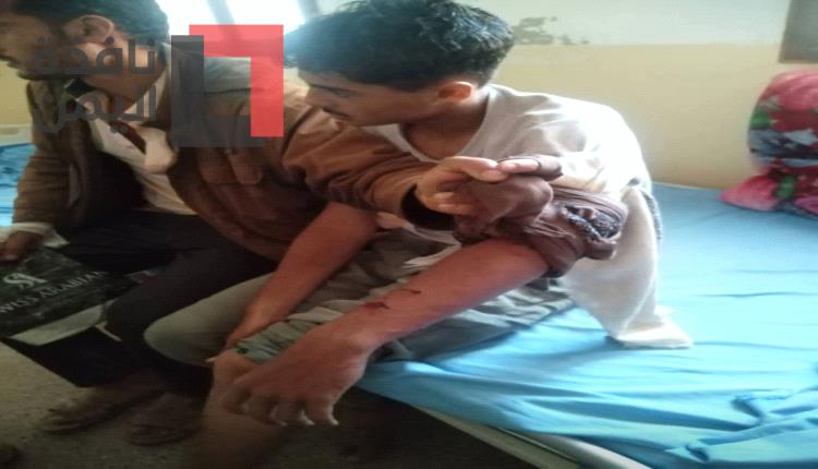 ظهور حالة سعار في مديرية الصلو.. ومطالبات بالتدخل لمواجهة الخطر الصحي