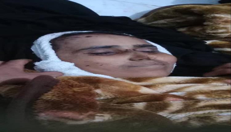 مسلحو الحوثي يعتدون بوحشية على امرأة أمام أبنها حتى الموت قبل نهب أموالها وسط شارع عام