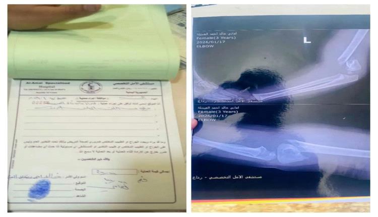 وفاة فتاة في مستشفى خاص برداع بعد عملية عظام بسيطة.. الأسرة تتهم الأطباء بـ"جريمة طبية"