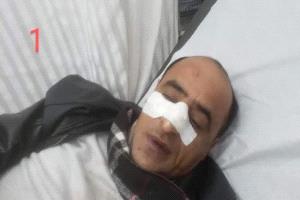 مسلحون يختطفون مستشار محافظ تعز بطريقة مهينة بعد الاعتداء عليه داخل مجلس مقيل