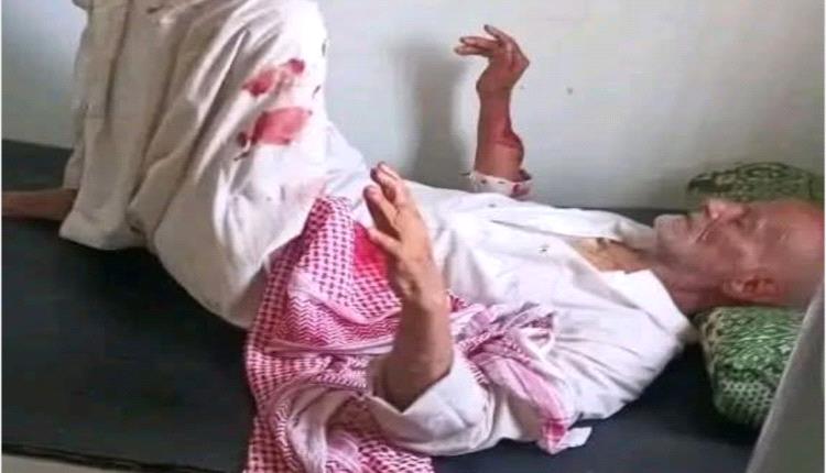إعتداء دموي على مسن.. يُبتر إصبعه ويُطعن بوحشية في مقبنة ومطالبات عاجلة بضبط الجاني