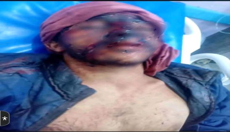 صاعقة تضرب مواطن داخل منزله أثناء استخدامه للهاتف ومضغه القات