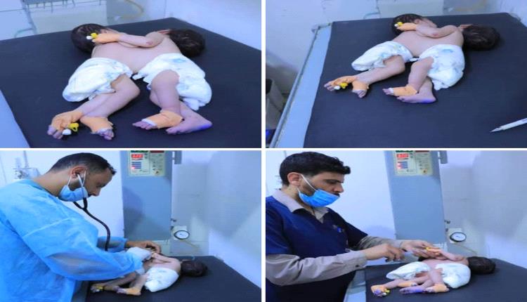 نداء عاجل من صنعاء وكل يوم تأخير يقرّب الموت.. توأم سيامي ينتظر معجزة طبية خارج اليمن