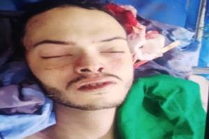 قيادي حوثي يقتل نجله في صنعاء أمام زوجته.. جريمة تفاصيلها تهز سكان العاصمة