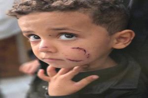كلاب مسعورة تحاصر طفل في تعز وإعلامي ينقذه نقاذه في اللحظة الأخيرة قبل نهشه