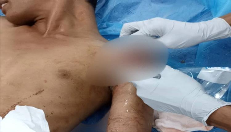 إرهاب الحوثي يطال شاب واقفه بالقرب من منزله في المسيمير