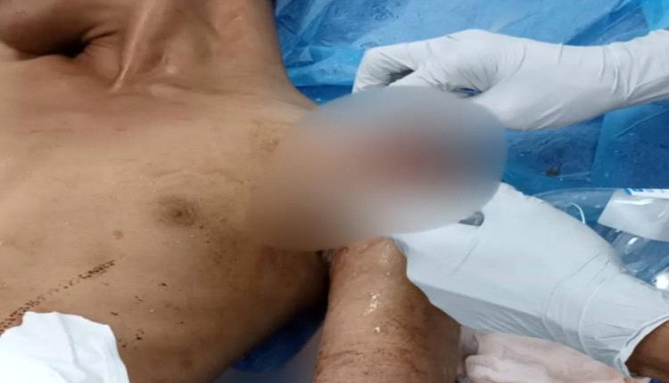 الحوثي يرسل شاب في الـ17 إلى مستشفى عدن برصاص غادر