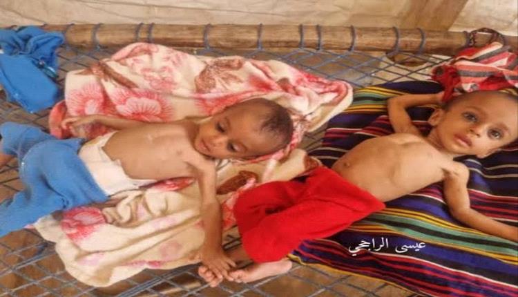 موت بطيء ينهش حجة.. أطباء بلا حدود ترصد ارتفاع صادم في وفيات الأطفال بسبب الجوع