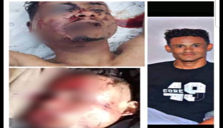 تعذيب شاب بوحشية حتى الموت بعد استدراجه في مناطق الحوثيين بتعز