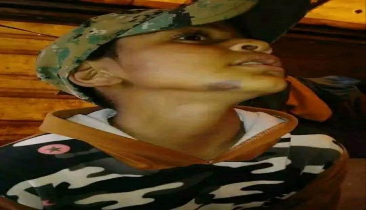 اعتداء صادم في صنعاء.. مسلح يهاجم طفلا يتيما ثم يدهس والده أمام المارة