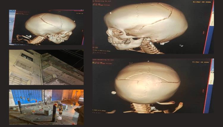 سقوط حجارة من مبنى متهالك في التواهي يصيب طفلة بشروخ في الجمجمة… ومطالبات بالتحقيق في الحادثة