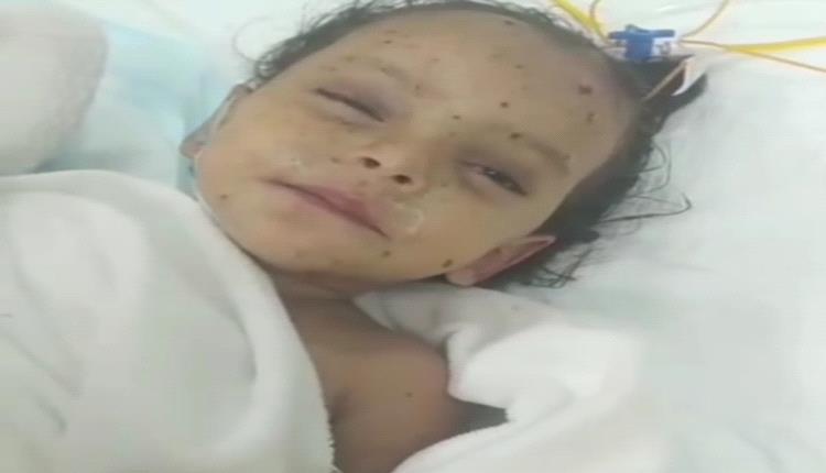 من تحت ركام المجزرة إلى الحياة.. الطفلة أسماء تغادر العناية بعد نجاتها من مجزرة إفطار حيران