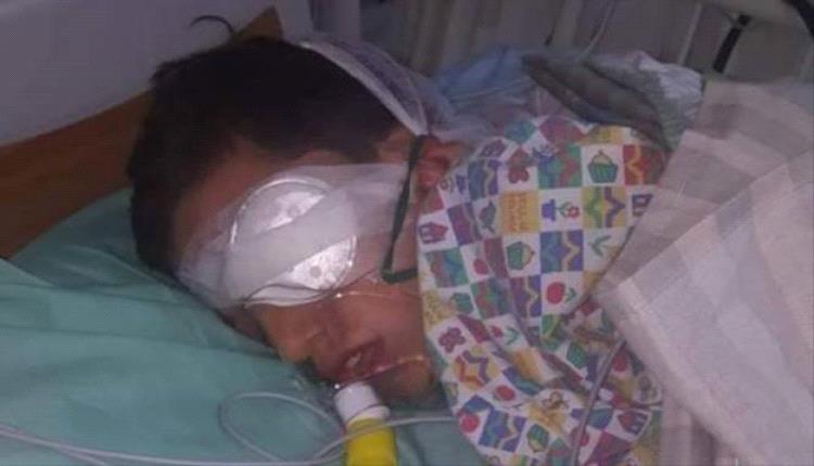 صنعاء تحت القصف الصامت.. تجار الحوثي يغرقون العاصمة بألعاب الموت وسقوط عشرات الجرحى