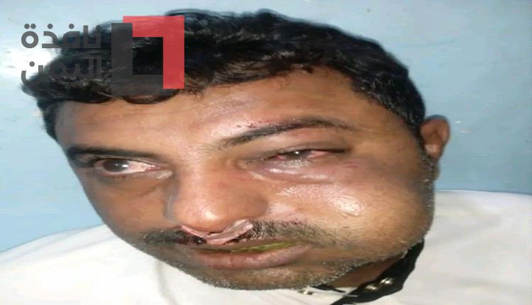 قيادي حوثي يحاول اغتيال محامي ويتركه غرقا في الدماء في شارع عام