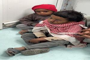 هجوم كلاب ضالة في صنعاء يُصيب طفلين وتحذير طبي خطير