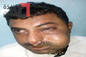 قيادي حوثي يحاول اغتيال محامي ويتركه غرقا في الدماء في شارع عام