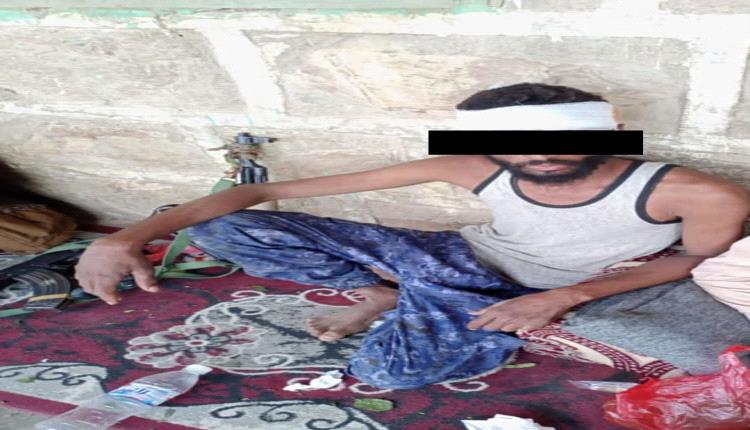 أمن أبين يكشف تفاصيل هجوم المتجمهرين ويؤكد: لن نسمح بكسر هيبة الدولة