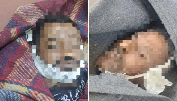ماس كهربائي ينهي حياة مهندسين أثناء صيانة الشبكة في المخا.. والشركة تحذر من الربط العشوائي