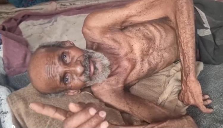 الجوع يقتل مسن وطفل في مخيمات النزوح بمناطق الحوثي