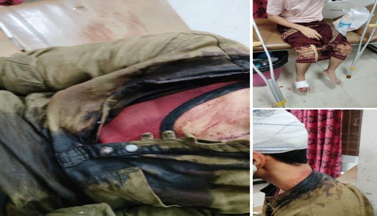 اعتداء جماعي دامي على طلاب من أبناء المخا في مدينة تعز
