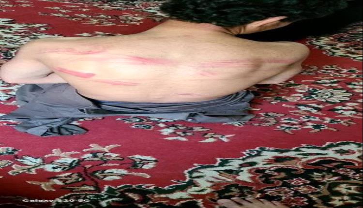 شاهد.. قيادي حوثي يعذب طفل داخل سجن سري في صعدة