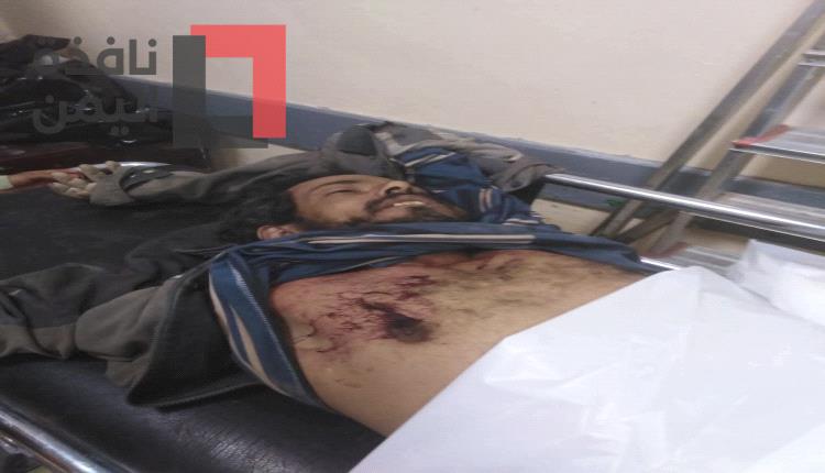 قيادي حوثي يصفي عامل من تعز داخل ورشة بصعدة بعد مطالبته بأجرة إصلاح سيارته