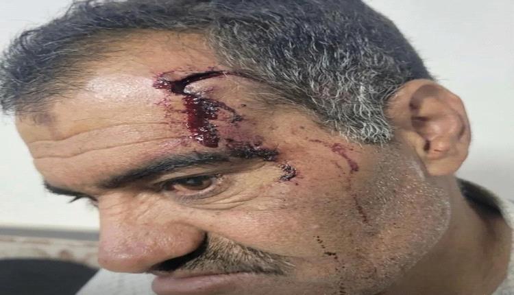 تعذيب وحشي لعاقل حارة في ذمار.. والسبب خلاف على إتاوات